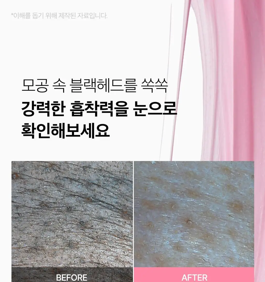 [피지뽑는] 에이프릴스킨 트라넥삼산 딥클렌저 120g 기획 (+15g 미니어처) 상세페이지 11